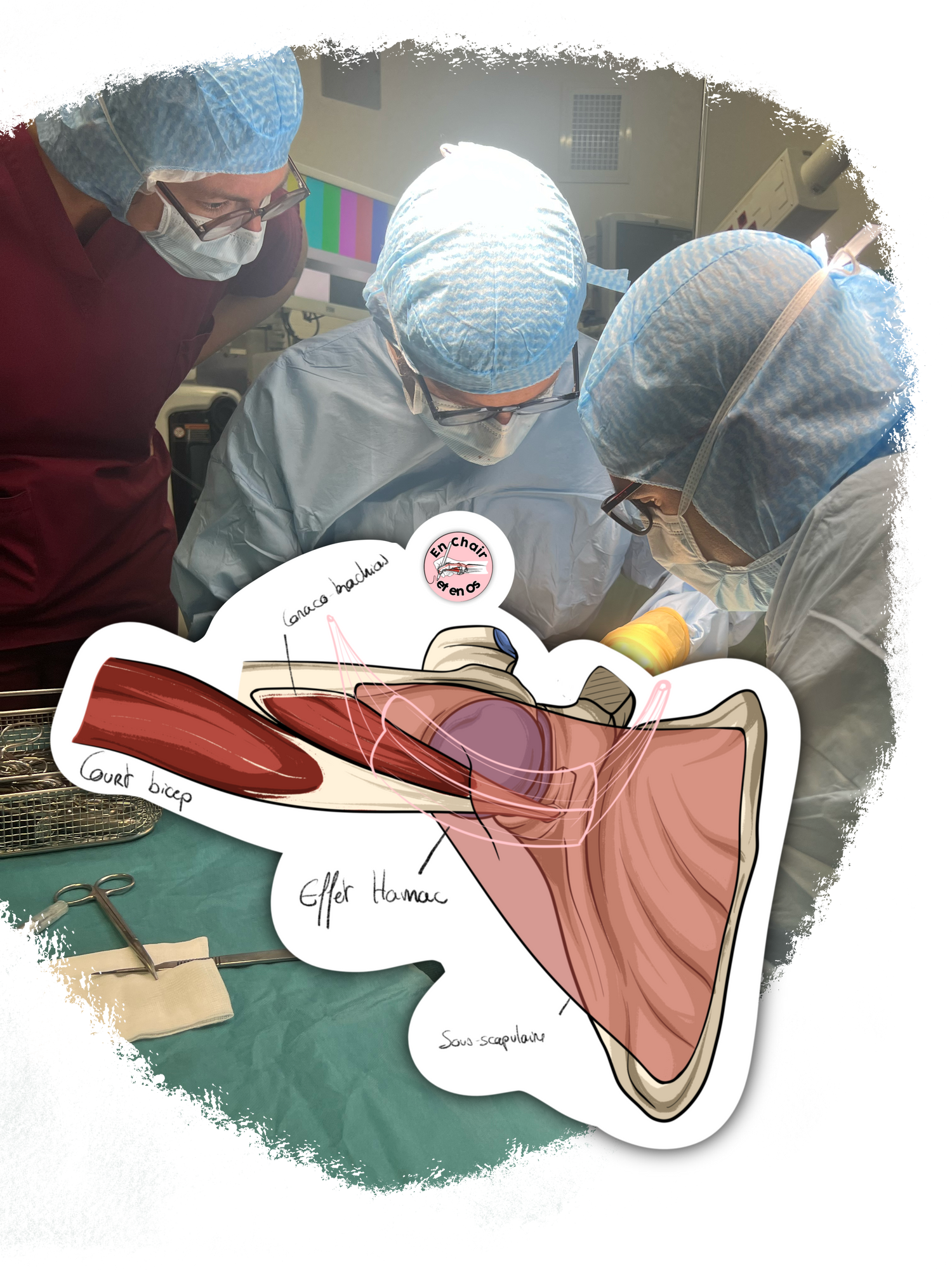 Dessin anatomique chirurgie de l'épaule En Chair et en Os décoration pour cabinet médical